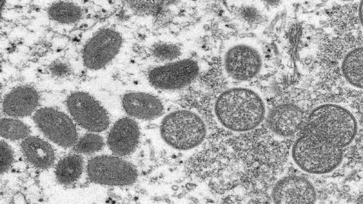 monkeypox-ap-1653702282